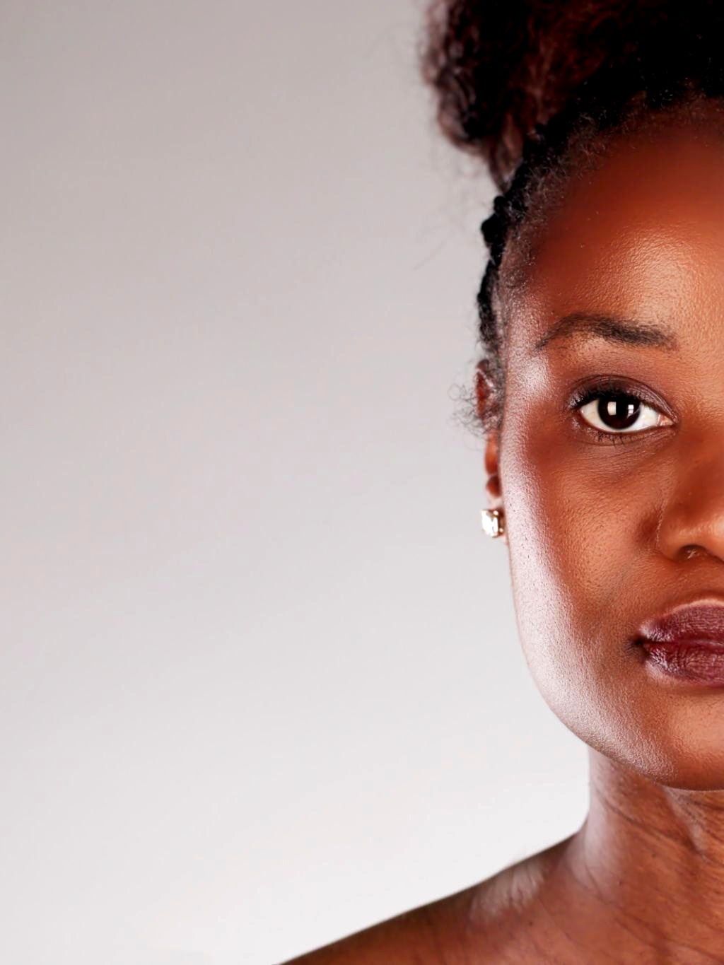 Nompumelelo D. LED Skin Rejuvenation result — after